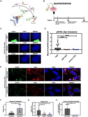 Poly (ADP-ribose) Interacts With Phosphorylated α-Synuclein in Post Mortem PD Samples